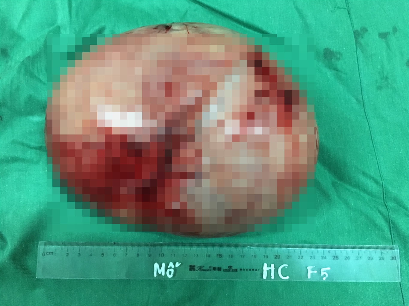 U xo tu cung 3 kg anh 1