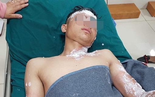 Hon 45.600 ca cap cuu vi tai nan giao thong trong 8 ngay nghi Tet hinh anh