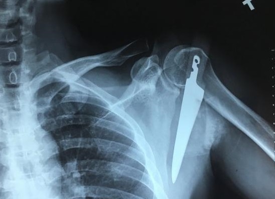 Dao dam vao vai vi vo tinh vap nga trong bep hinh anh