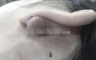 Co gai cat bo seo loi to bang hat lac vi xo khuyen tai hinh anh