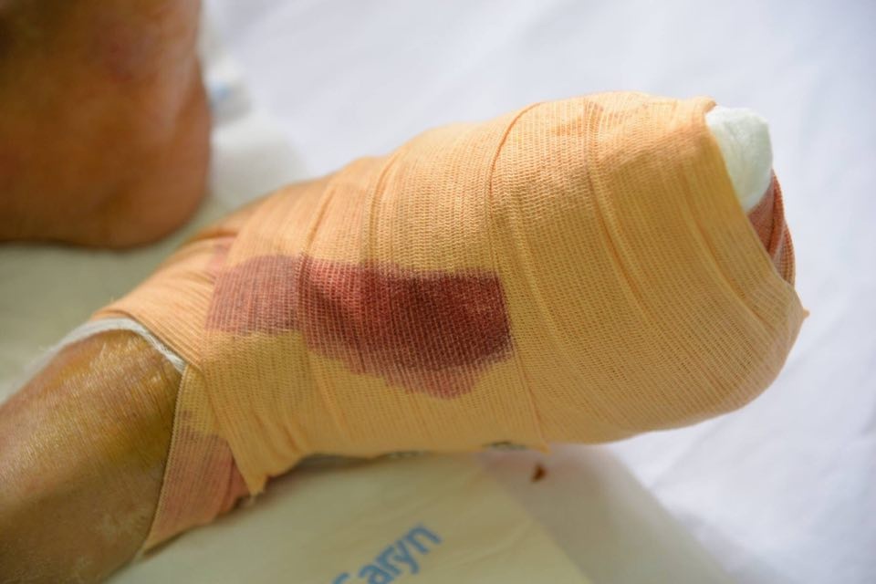 Bệnh đái tháo đường ảnh 2 Benh dai thao duong anh 2