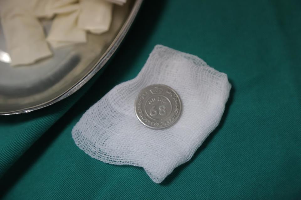 em bé hóc đồng xu ảnh 1 em be hoc dong xu anh 1