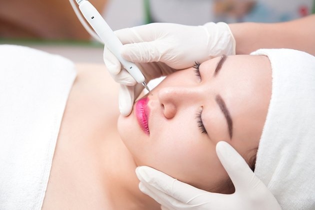 Lưu ý khi tẩy nốt ruồi ảnh 2 Luu y khi tay not ruoi anh 2