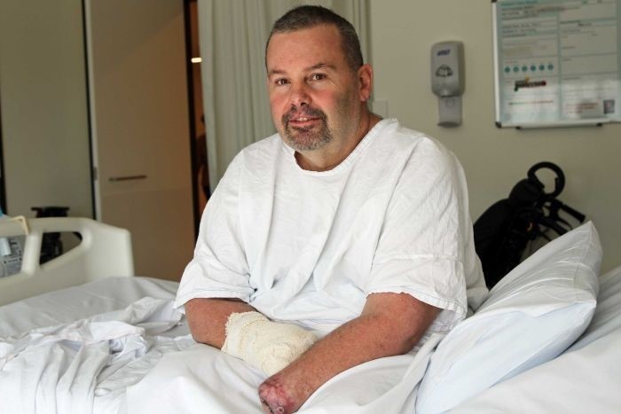 cắt cụt tay chân vì nhiễm khuẩn ảnh 1 cat cut tay chan vi nhiem khuan anh 1