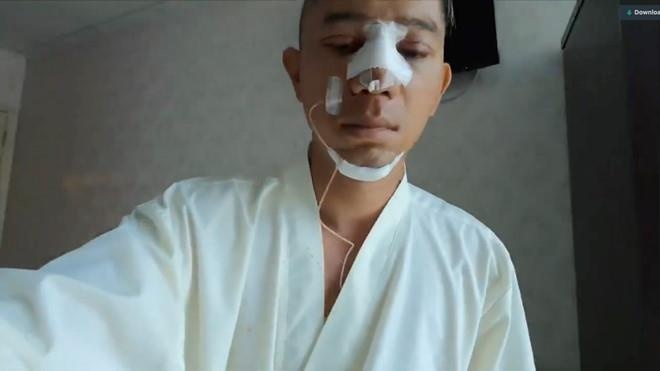 Lương Bằng Quang phẫu thuật thẩm mỹ ảnh 2 Luong Bang Quang phau thuat tham my anh 2
