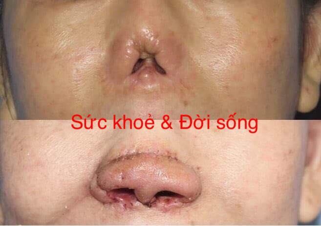 tai tao dau mui bi mat anh 1