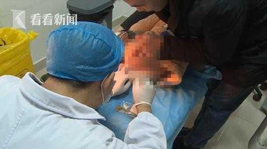 bé trai tụt hậu môn vì ăn vặt quá nhiều ảnh 1 be trai tut hau mon vi an vat qua nhieu anh 1