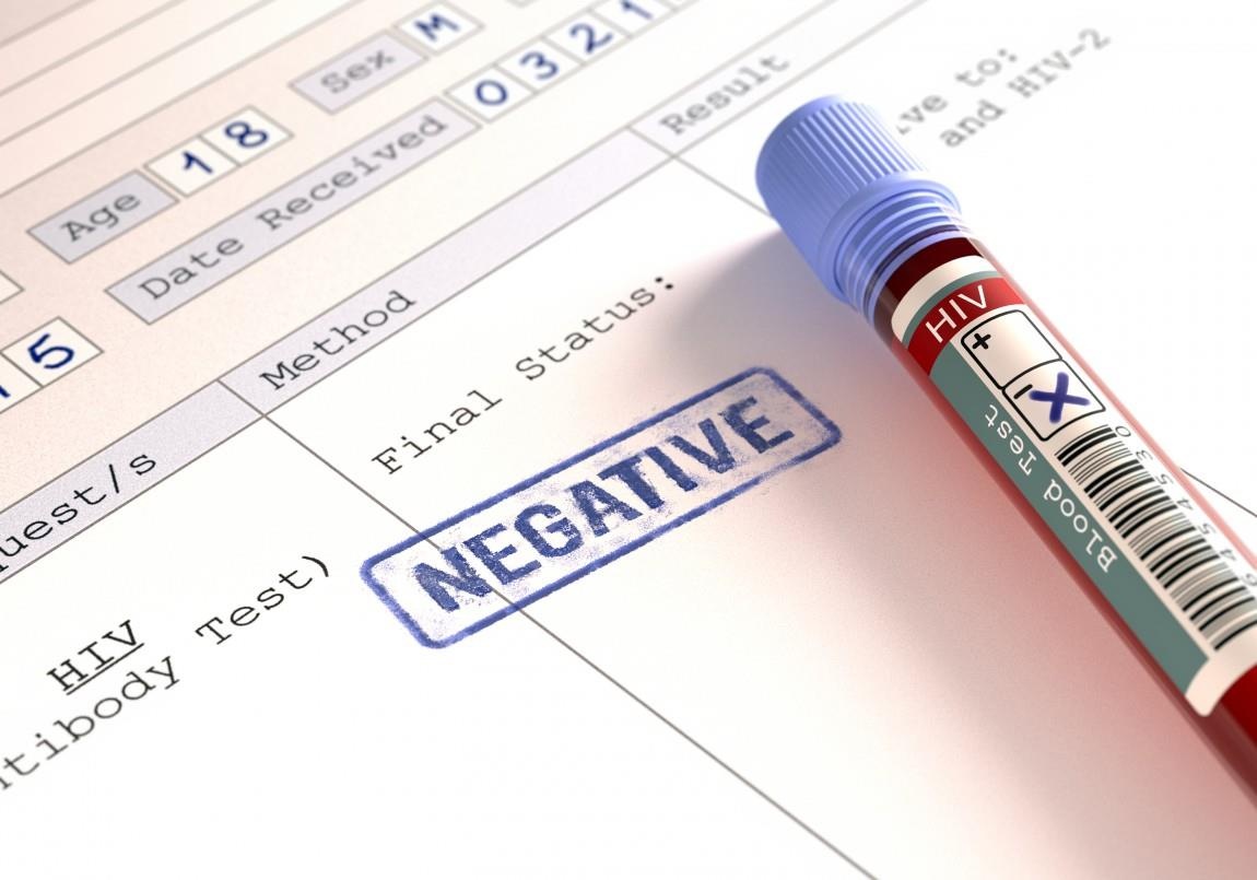 phơi nhiễm HIV ảnh 2 phoi nhiem HIV anh 2