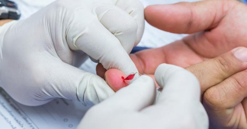 phơi nhiễm HIV ảnh 6 phoi nhiem HIV anh 6