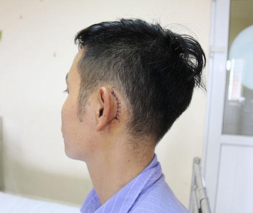 điện thoại phát nổ khi đang sạc ảnh 1 dien thoai phat no khi dang sac anh 1