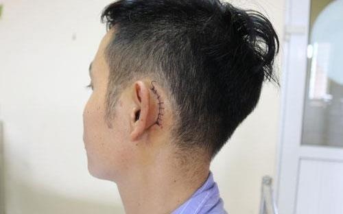 Thung mang nhi vi dien thoai phat no khi dang sac giua dem hinh anh