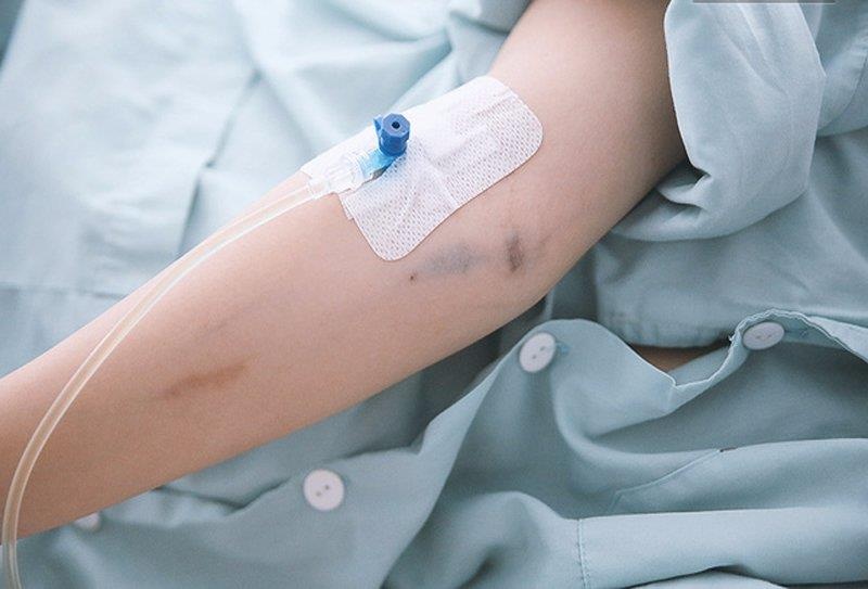 Truyền dịch đúng cách ảnh 2 Truyen dich dung cach anh 2