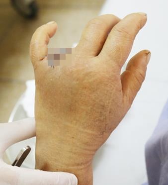 mất ngón tay vì mắc nhẫn vào cửa xe ôtô ảnh 1 mat ngon tay vi mac nhan vao cua xe oto anh 1