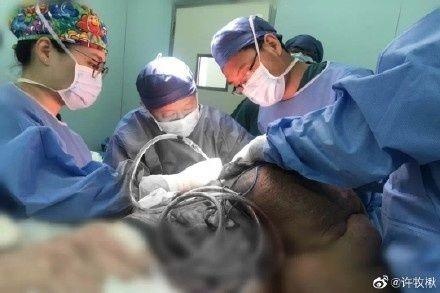khối u 28 kg trên lưng ảnh 1 khoi u 28 kg tren lung anh 1