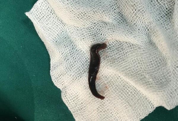 Dia trau dai 15 cm song trong khi quan hinh anh