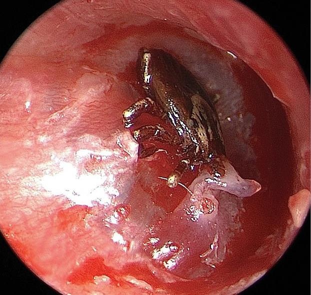 Kinh hoang ve cho chui vao mang nhi anh 1