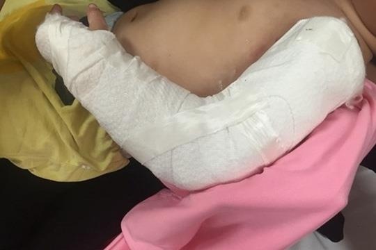 Xe tai tong khien be trai 19 thang tuoi dap nat hoan toan canh tay hinh anh