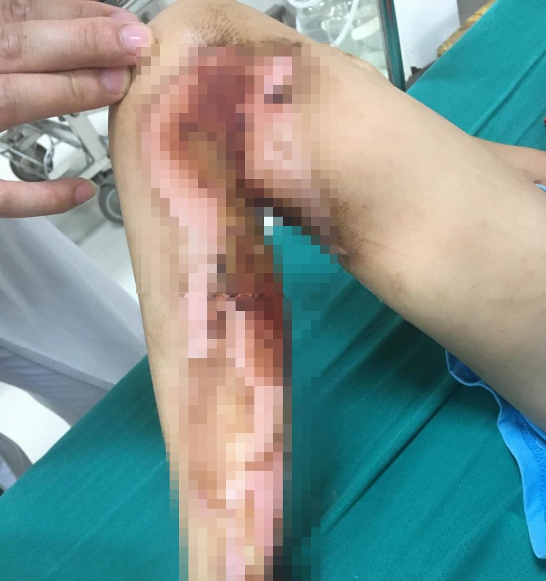 Dap thuoc nam chua bong anh 1