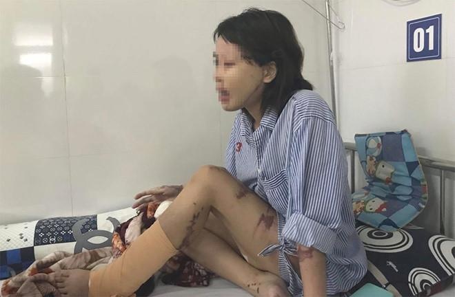 co gai bi chong sap cuoi tat axit anh 1