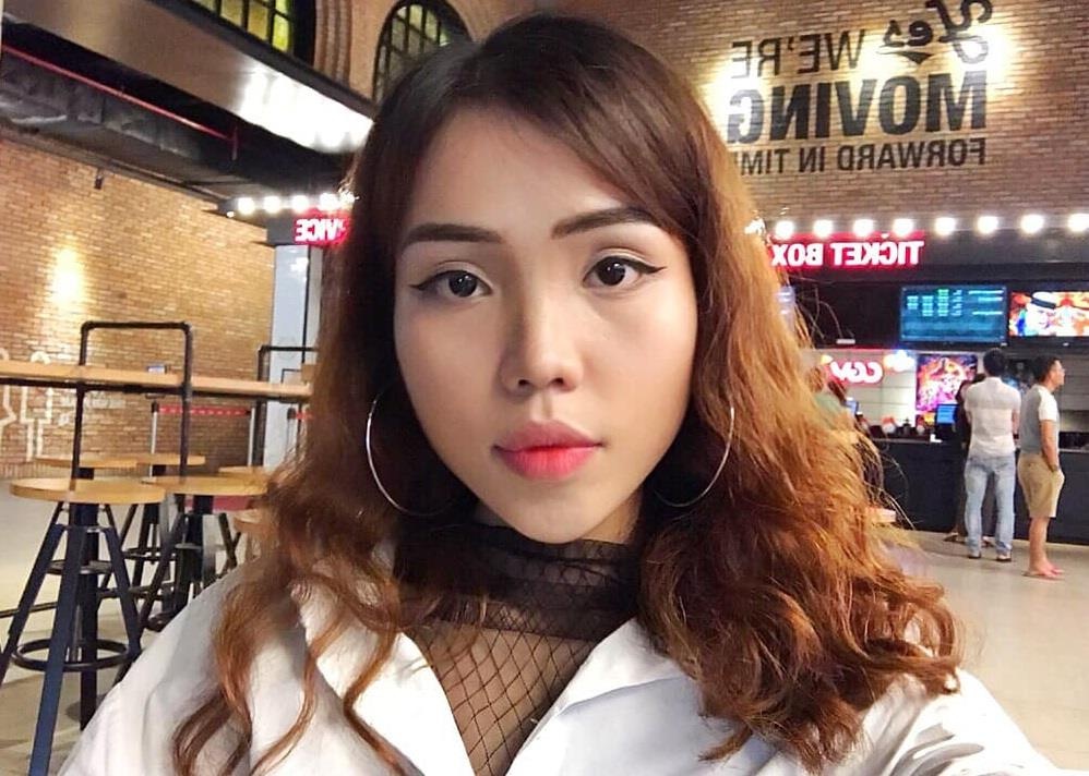 Co gai bi chong sap cuoi tat axit co the phuc hoi khuon mat? hinh anh