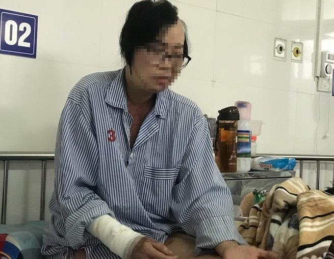 Cô giáo bị chồng cũ tạt axit ảnh 2 Co giao bi chong cu tat axit anh 2