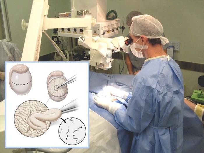 điều trị vô sinh ở nam giới ảnh 1 dieu tri vo sinh o nam gioi anh 1