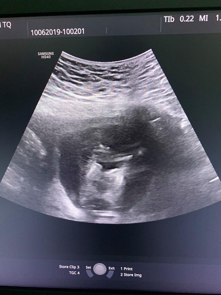 Song thai dinh lien hiem gap anh 1