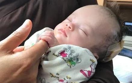 Em be bi treo tren cay, duoc nha su dua sang Singapore dieu tri hinh anh