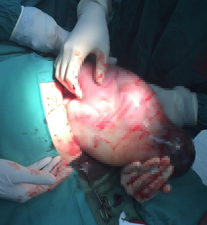 be gai chao doi con nguyen trong boc oi anh 1