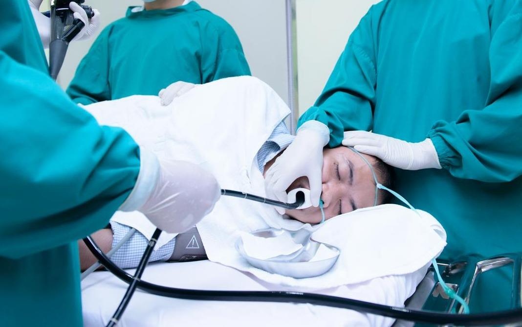 Co nen gay me khi noi soi da day? hinh anh