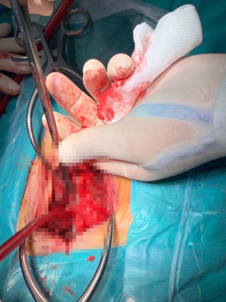 thanh nien cam que xien thit dam vao lung ban anh 1