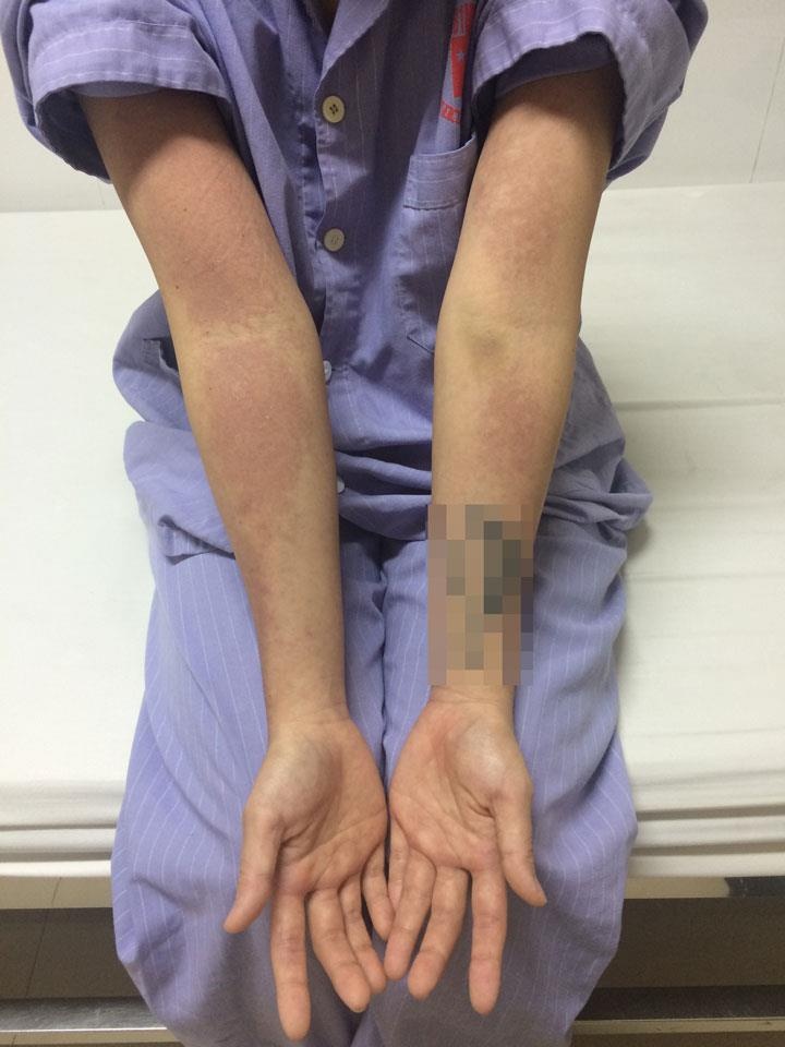 Di ung toan than vi my pham anh 1