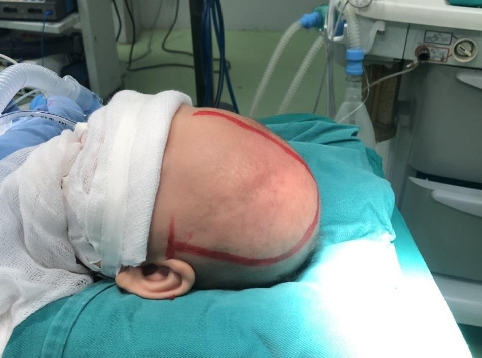 Bé trai Phú Thọ có đầu nhỏ mãi  ảnh 1 Be trai Phu Tho co dau nho mai anh 1