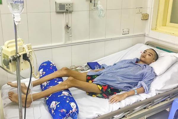 Phổi cậu bé 15 tuổi mọc nấm ảnh 1 Phoi cau be 15 tuoi moc nam anh 1