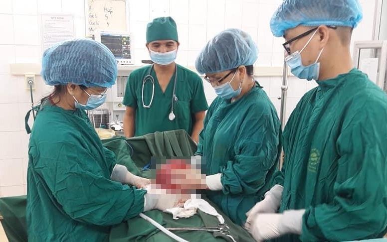 U xo tu cung lon nhanh nhu thoi vi uong nhieu mam dau nanh hinh anh