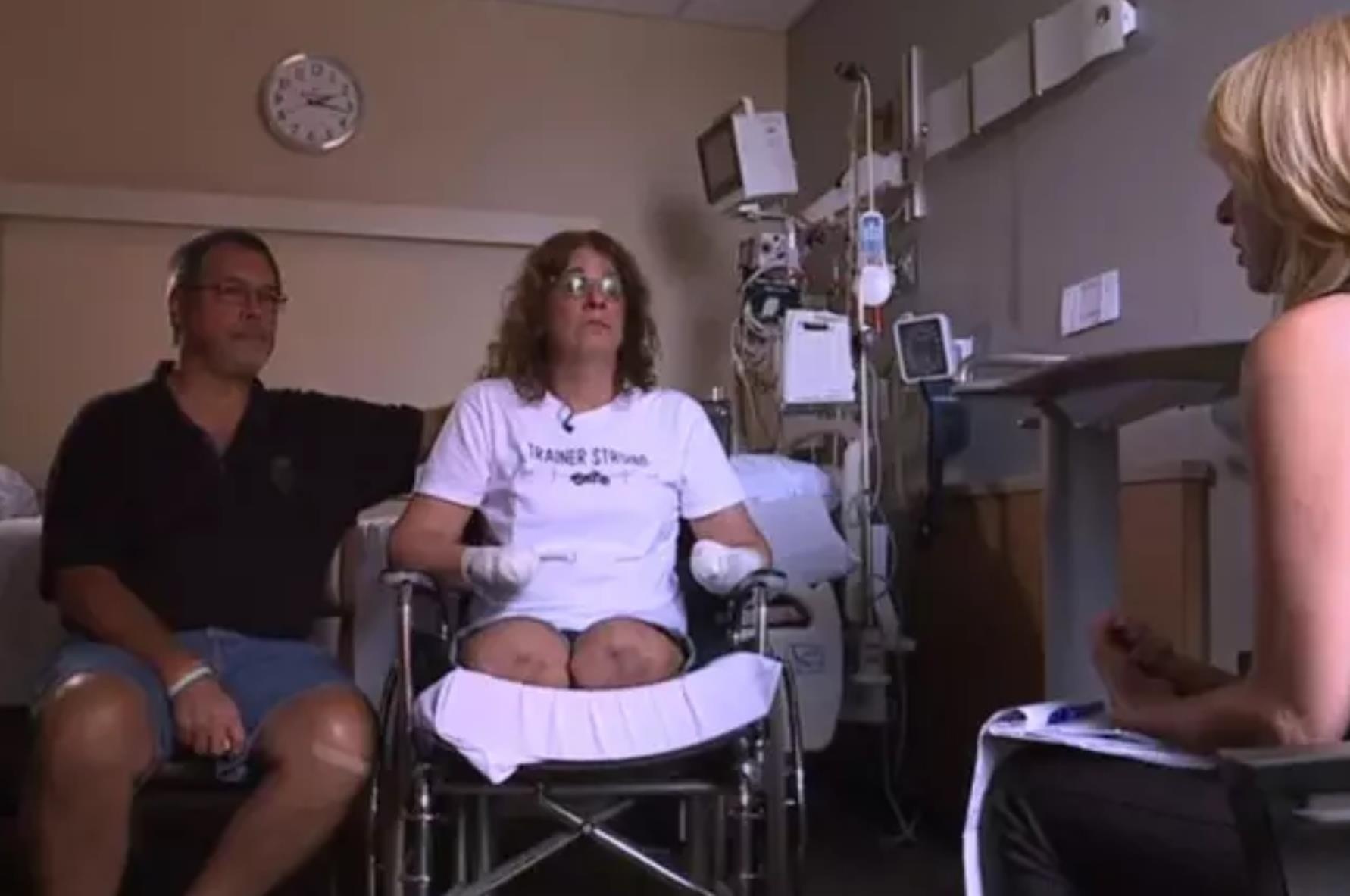 cắt cụt tứ chi vì thú cưng liếm vào tay ảnh 1 cat cut tu chi vi thu cung liem vao tay anh 1