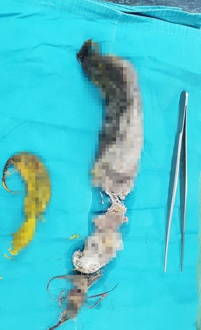 benh nhi 5 tuoi thich an toc anh 1