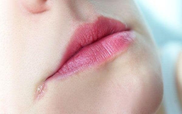 Lam gi khi bi gioi leo? hinh anh