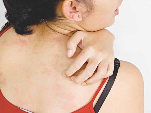 chua benh gioi leo anh 2