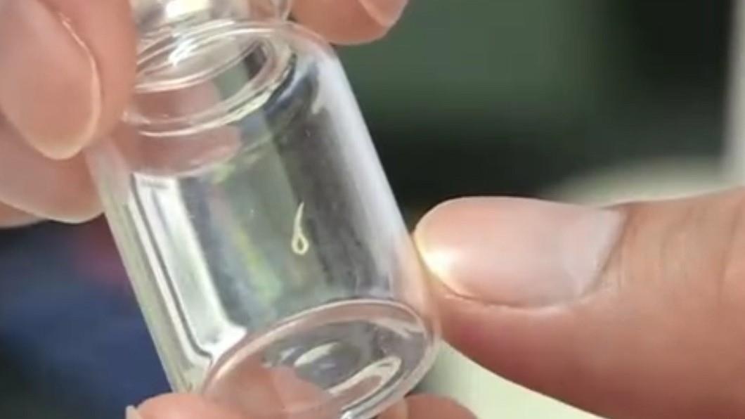 giun trong mat cau be 2 tuoi anh 2