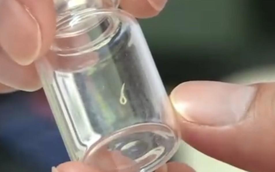 Giun bo trong mat cau be 2 tuoi vi thuong xuyen choi voi thu cung hinh anh