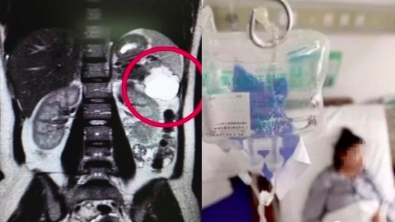 Mat thai song sinh vi an banh day anh 1