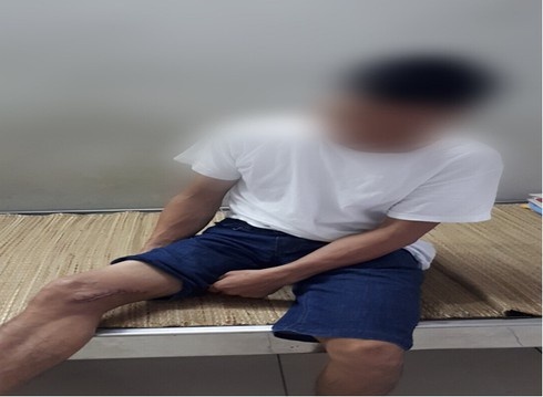 vi khuẩn Whitmore ảnh 1 vi khuan Whitmore anh 1