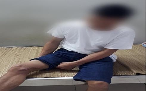 Vi khuan Whitmore tan cong nam benh nhan Thai Nguyen hinh anh