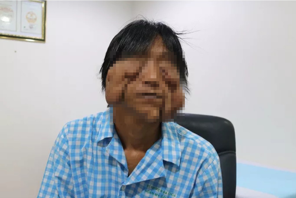 guong mat bien dang anh 1