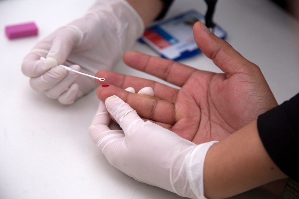 Điều trị HIV/AIDS ảnh 1 Dieu tri HIV/AIDS anh 1