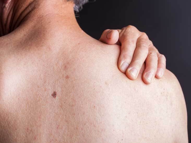 Điều trị HIV/AIDS ảnh 2 Dieu tri HIV/AIDS anh 2