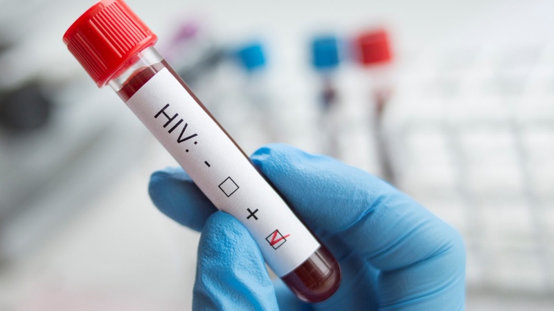 Điều trị HIV/AIDS ảnh 5 Dieu tri HIV/AIDS anh 5