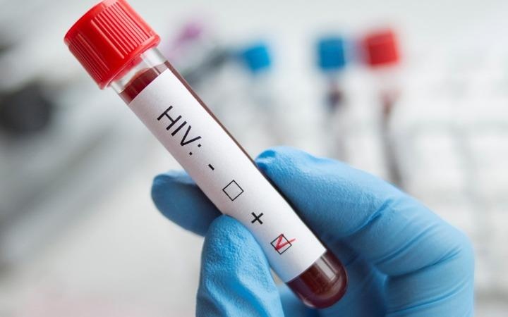 Khong con vo phuong cuu chua, HIV duoc dieu tri the nao? hinh anh