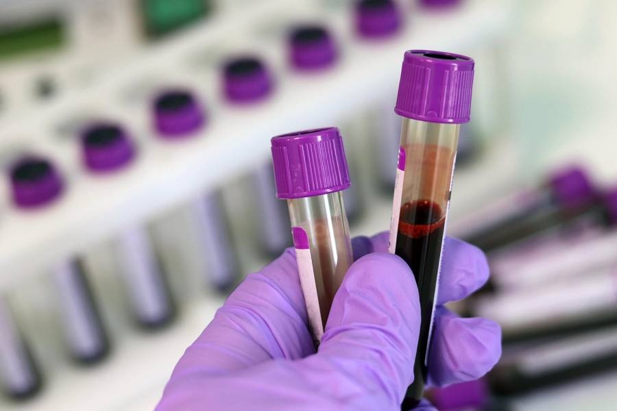 Điều trị HIV/AIDS ảnh 6 Dieu tri HIV/AIDS anh 6